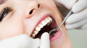 woman receiving dental work