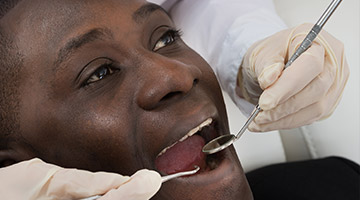 dentist checking man's smile