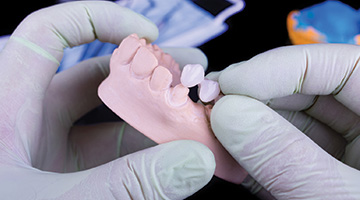 dentist placing on a bridge